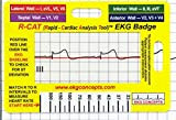 Getue R-Cat EKG Badge